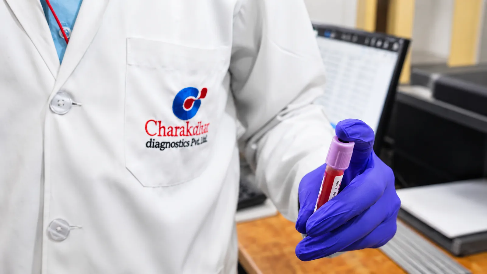 A Charakdhar Diagnostics technologist holding a labelled blood sample